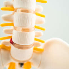 Omurilik uyarılması nedir?